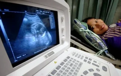 Amankah USG Bagi Ibu Hamil Dan Perkembangan Janin?
