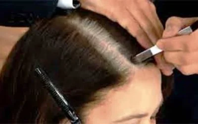 Tips Jitu Menghilangkan Uban Dengan Cara Alami