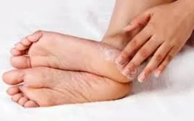 Penyebab dan Cara Mengatasi Kaki Pecah-pecah