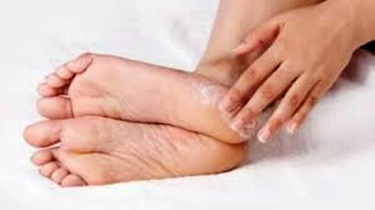 Penyebab dan Cara Mengatasi Kaki Pecah-pecah