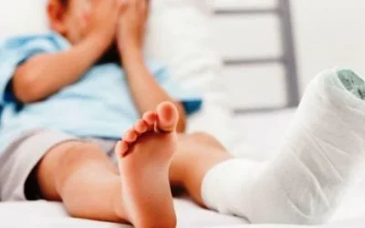 Tips Jitu Mengobati Keseleo