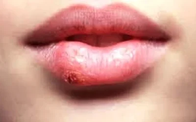 Ternyata Inilah Alasan Kenapa Tidak Boleh Berbagi Lipstik