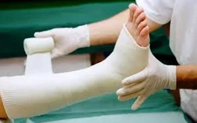 Tips Cepat Sembuh Dari Patah Tulang