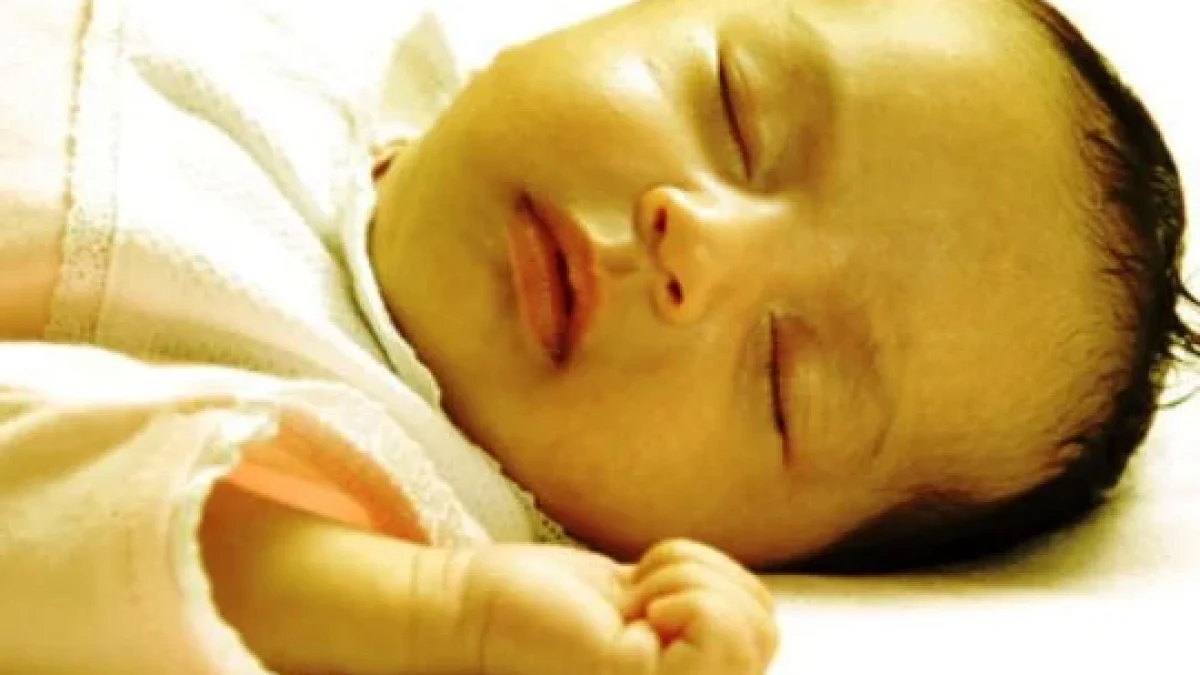 Tips Merawat Bayi Kuning
