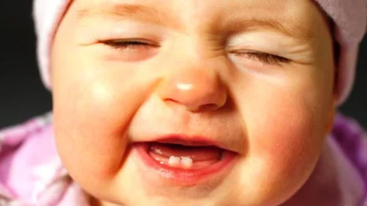 Tips Merawat Gigi Bayi dan Anak