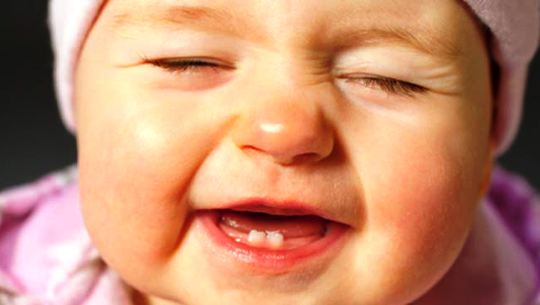 tips merawat gigi bayi dan anak