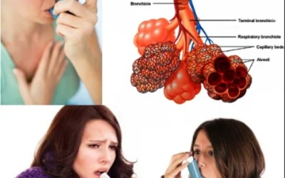 Mengenal Penyakit Asma Tipe, Gejala, dan Penyebab Asma