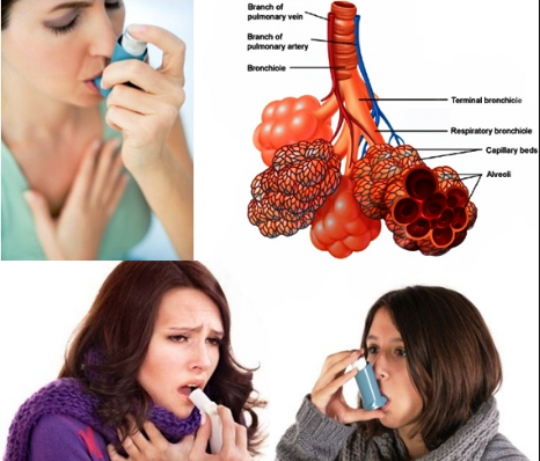 mengena gejala penyakit asma