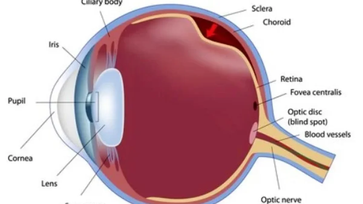 Ablasi Retina. Definisi, Penyebab, Pengobatan