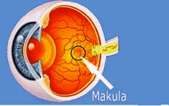 Degenerasi Makula: Penyebab, Gejala, Dan Pengobatan