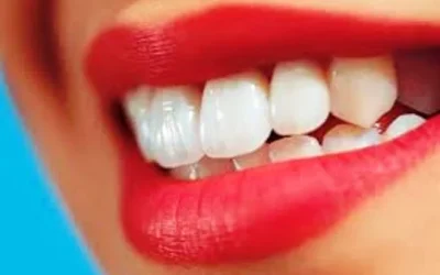 Tips Memutihkan Gigi Cepat Dan Alami