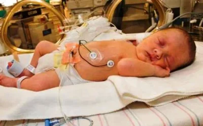 Tips Merawat Bayi Prematur