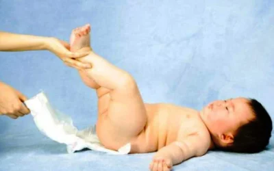 Cradle Cap Serta Lecet Pada Bayi dan Cara Mengatasinya