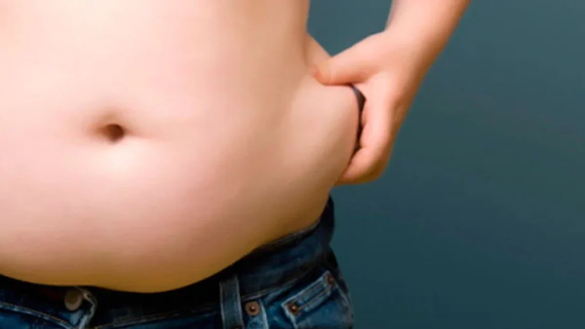 Inilah Jenis Obesitas dan Solusinya yang Perlu Diketahui, Manakah Anda?