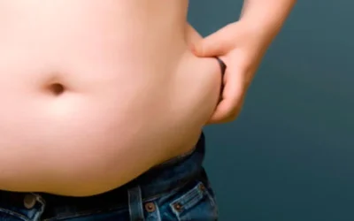 Inilah Jenis Obesitas dan Solusinya yang Perlu Diketahui, Manakah Anda?