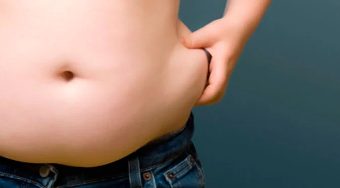 Inilah Jenis Obesitas dan Solusinya yang Perlu Diketahui, Manakah Anda?