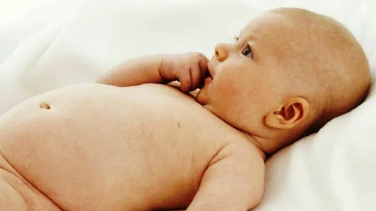 Penyebab Penyakit Kuning Pada Bayi Baru Lahir, Waspadai Untuk Mengantisipasi Buruk