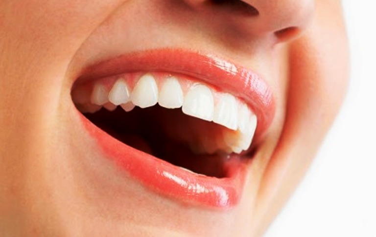 5 Permasalahan Mulut Dan Gigi Yang Perlu Segera Ditangani