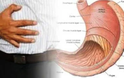 Puasa Ramadhan Bisa Menyembuhkan Penyakit Maag