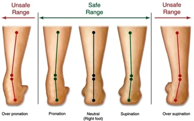 Kelainan Kaki Pada Anak, Kenali Sebelum Terlambat