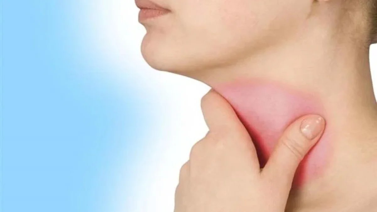 8 Cara Ampuh Mengobati Panas Dalam Dengan Bahan Alami