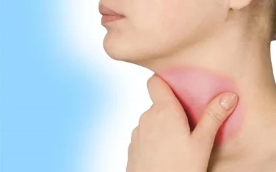8 Cara Ampuh Mengobati Panas Dalam Dengan Bahan Alami