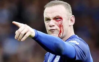 Kronologi dan FOTO Wayne Rooney Berdarah-darah Hadapi Bournemouth