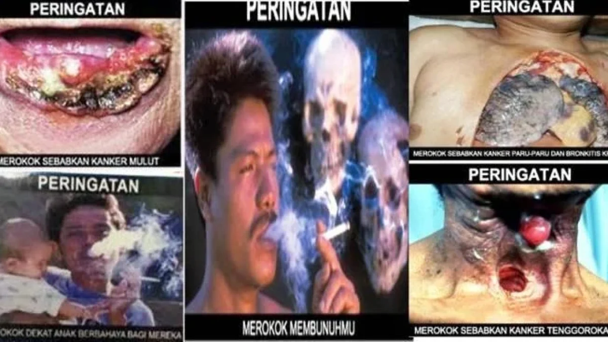 Bahaya Merokok Bagi Pelajar Yang Dapat Menyebabkan Kanker