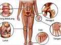 Cara Mengobati Penyakit Rematik Tulang Ampuh dengan Bahan Alami