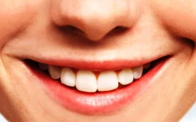 Tips dan Cara Memutihkan Gigi yang Kuning Secara Alami Cepat Paling Ampuh