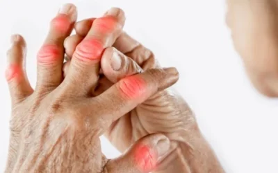 Inilah Solusi Hemat Biaya untuk Pengobatan Rheumatoid Arthritis